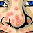Acne Zit Popper